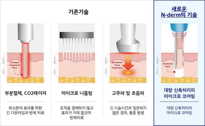 엔덤기술